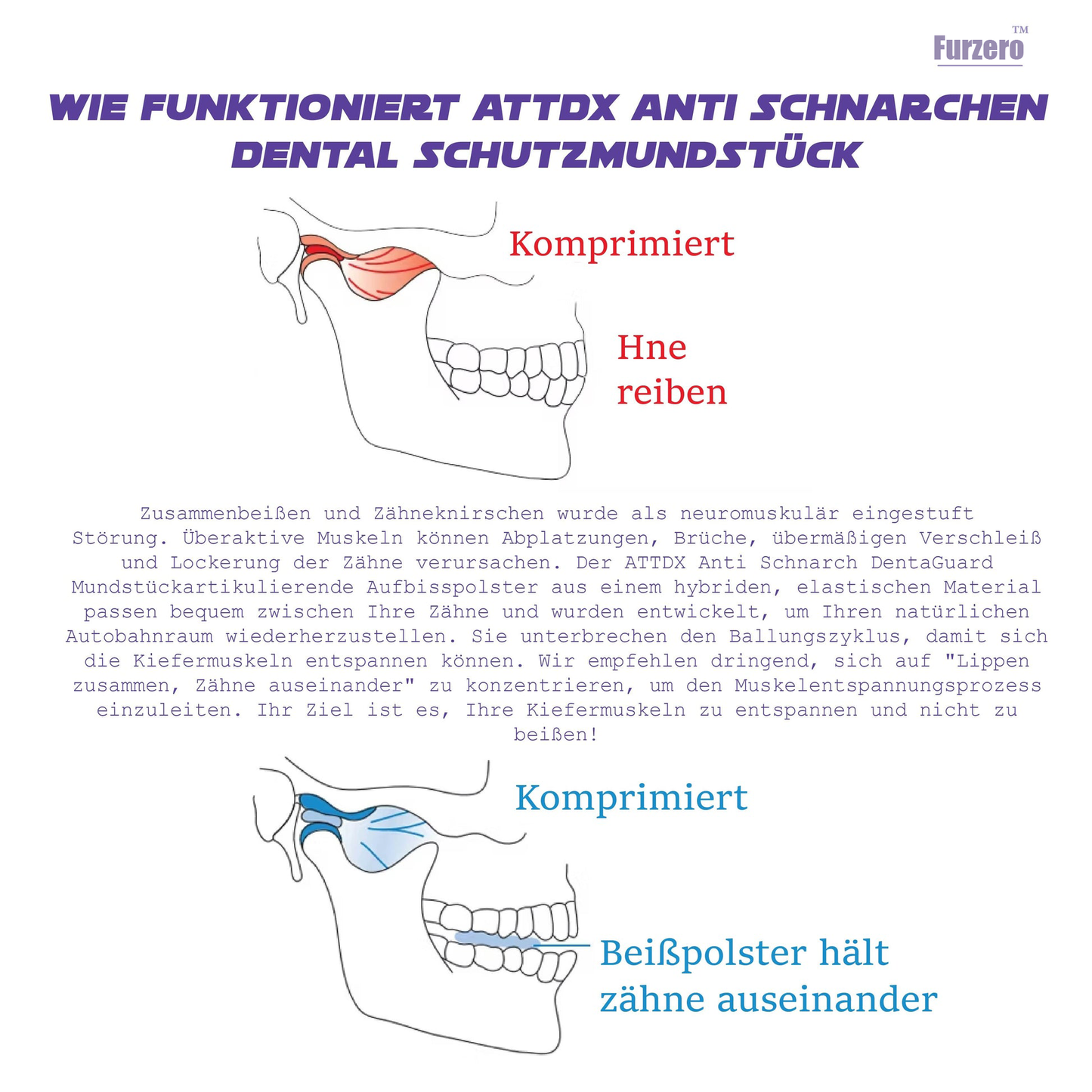 Furzero™ AntiSchnarchen DentaWächter Mundstück